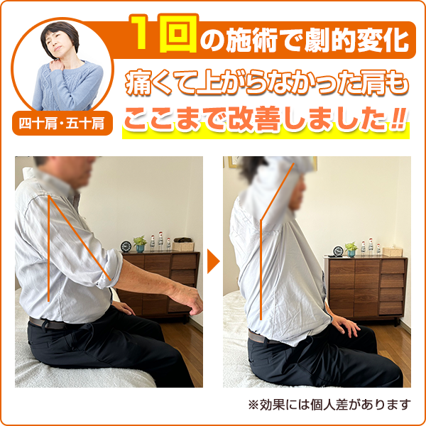 ビフォーアフター